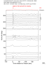 Time Azimuth binned coda stacks 0.05 - 0.2 Hz Vertical