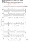 Time Azimuth binned coda stacks 0.05 - 0.2 Hz Vertical