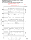 Time Azimuth binned coda stacks 0.05 - 0.2 Hz Vertical