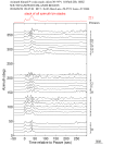 Time Azimuth binned coda stacks 0.05 - 0.2 Hz Vertical