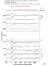 Time Azimuth binned coda stacks 0.05 - 0.2 Hz Vertical