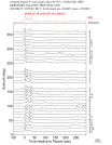 Time Azimuth binned coda stacks 0.05 - 0.2 Hz Vertical