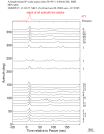 Time Azimuth binned coda stacks 0.05 - 0.2 Hz Vertical