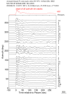 Time Azimuth binned coda stacks 0.05 - 0.2 Hz Vertical