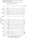 Time Azimuth binned coda stacks 0.05 - 0.2 Hz Vertical