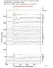 Time Azimuth binned coda stacks 0.05 - 0.2 Hz Vertical