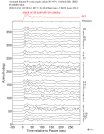 Time Azimuth binned coda stacks 0.05 - 0.2 Hz Vertical