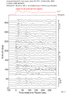 Time Azimuth binned coda stacks 0.05 - 0.2 Hz Vertical