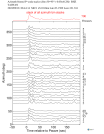 Time Azimuth binned coda stacks 0.05 - 0.2 Hz Vertical
