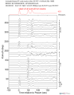 Time Azimuth binned coda stacks 0.05 - 0.2 Hz Vertical