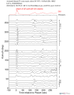 Time Azimuth binned coda stacks 0.05 - 0.2 Hz Vertical
