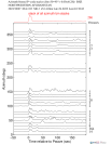 Time Azimuth binned coda stacks 0.05 - 0.2 Hz Vertical