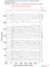 Time Azimuth binned coda stacks 0.05 - 0.2 Hz Vertical
