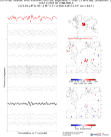 EU virtual network, multi-channel cross-corr, alignment